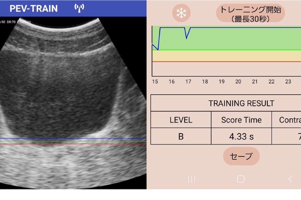 泌尿器科専門医と共同開発　スマホで「骨盤底トレーニング」できるアプリ 画像